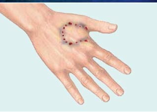 狂犬病有哪些表现及如何诊断？