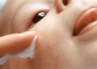 你知道皮肤过敏的症状有哪些吗