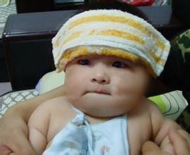 小儿发烧引起的并发症有哪些？