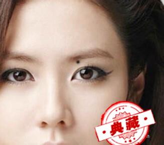 脸上有痣怎么去掉？有没有不用去医院的办法？