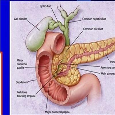胰腺炎患者能吃蜂蜜吗