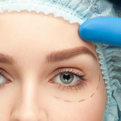 脸上痤疮是什么原因引起的