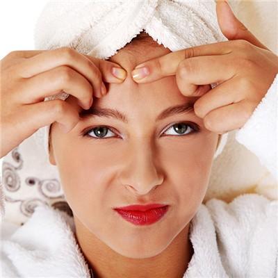 青春期痤疮怎么治