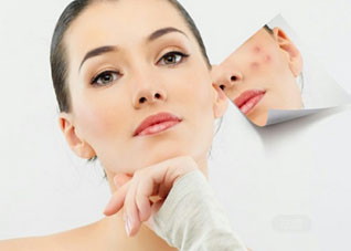 青春期祛痘不能远离的食物