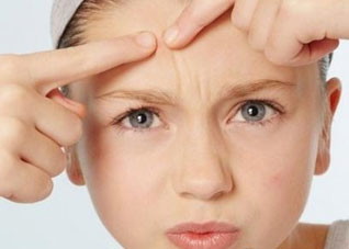 女人长痘离不开痘痘的护理三步骤