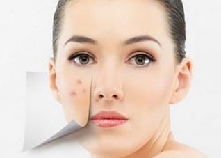 难道脸上长痘痘会传染吗