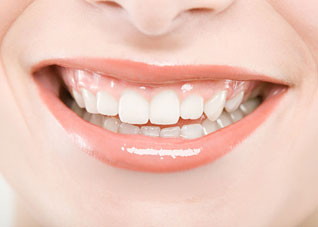 美白牙齿的妙招有哪些