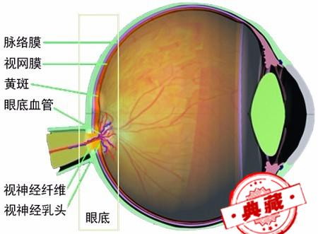 动脉硬化与高血压有哪些眼部病变表现