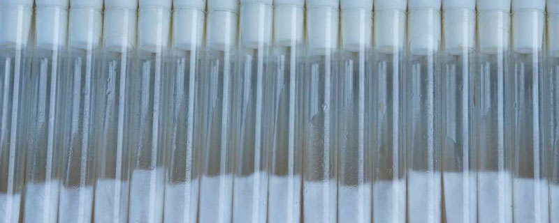 短期保存菌种的方法 长期保存菌种的方法