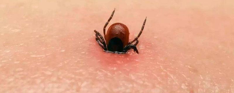 蜱虫怎么治疗用什么药 蜱虫怎么消灭用什么药