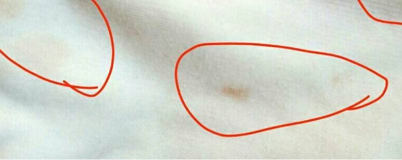 白色裙子上有黄色污渍怎么洗掉 白裙子的黄色污渍
