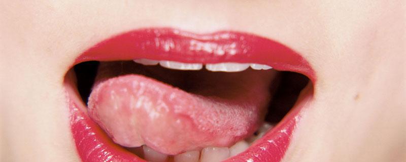 裂纹舌跟胃有关系吗 裂纹舌是胃病吗