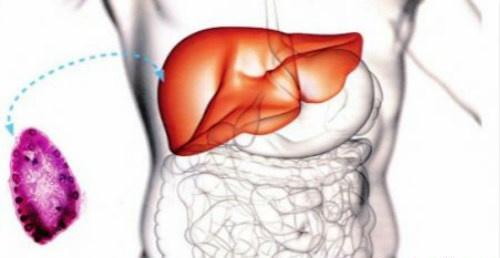肝囊肿的治疗 肝囊肿的治疗方法