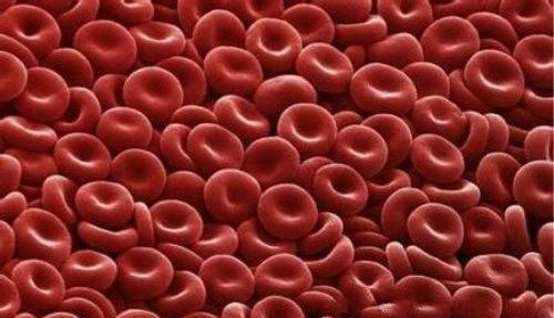 红细胞压积（红细胞压积偏高）