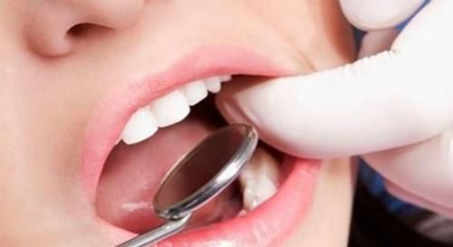 牙龈肿胀的偏方 牙龈肿胀的治疗方法
