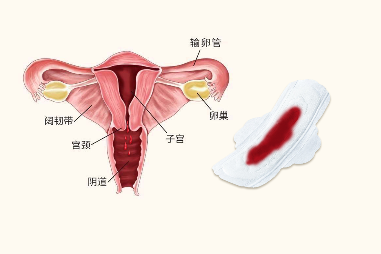 阴道不规则出血图片