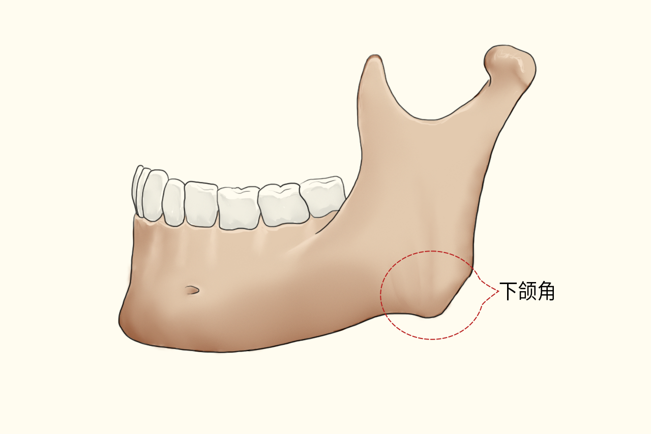 标准的下颌角图片（正常人的下颌角图片）
