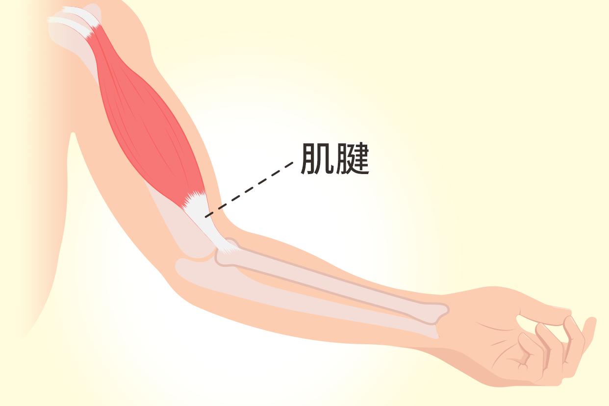 肌腱和韧带的区别图片 肌腱和韧带的区别图片解析