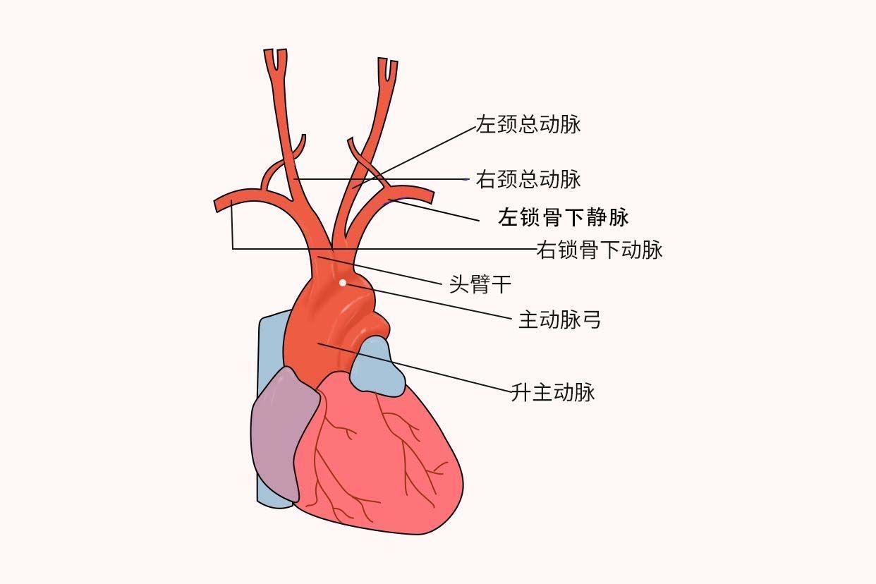 主动脉弓位置示意图 主动脉弓的位置图