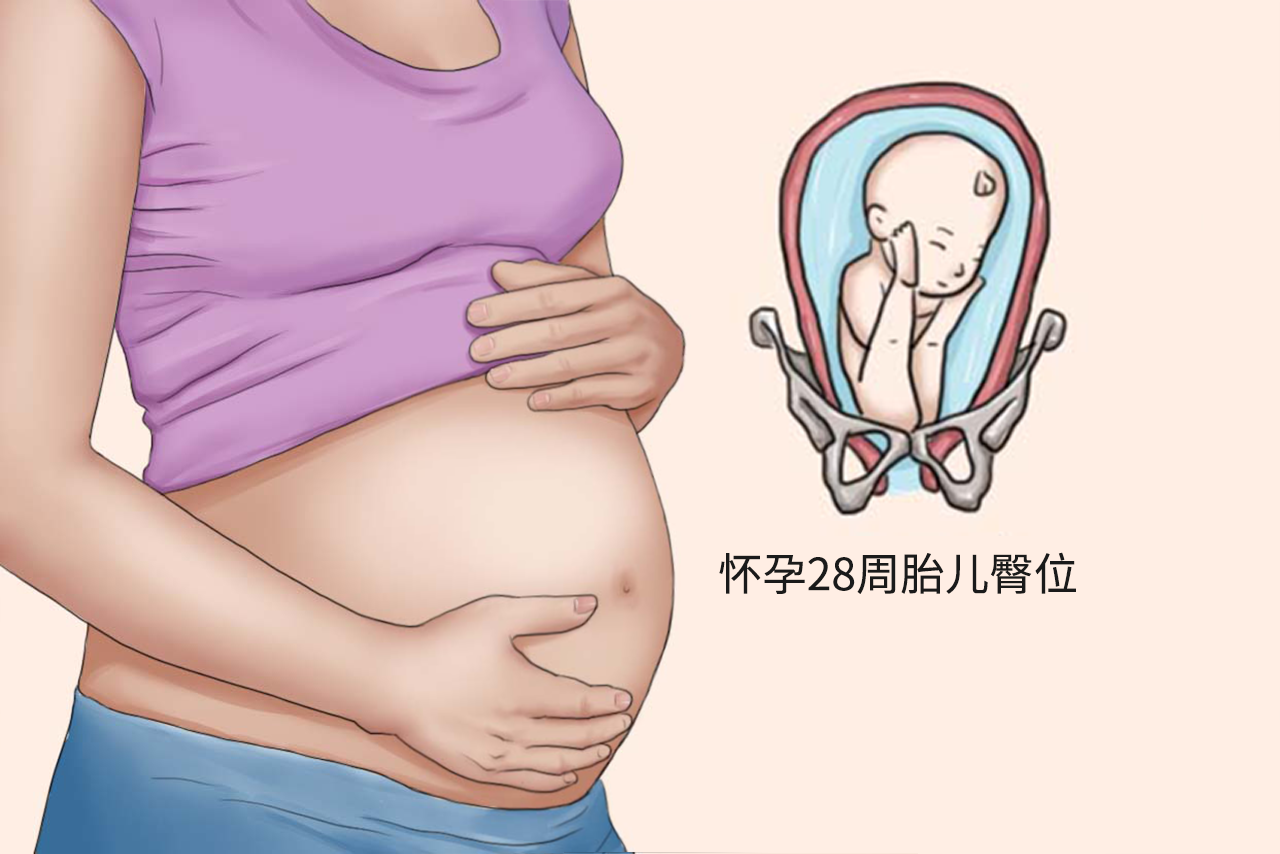怀孕28周胎儿臀位图片（孕28周胎位臀位纠正图）