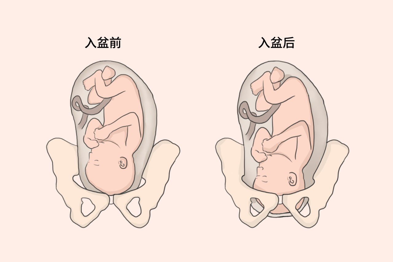 怀孕36周胎儿入盆图 怀孕36周胎儿入盆图解