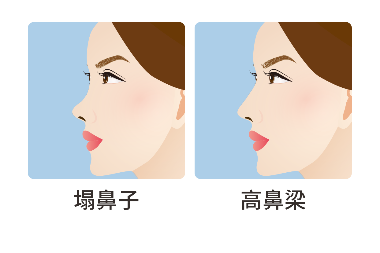 塌鼻子和高鼻梁对比图（塌鼻子和高鼻梁对比图卡通）