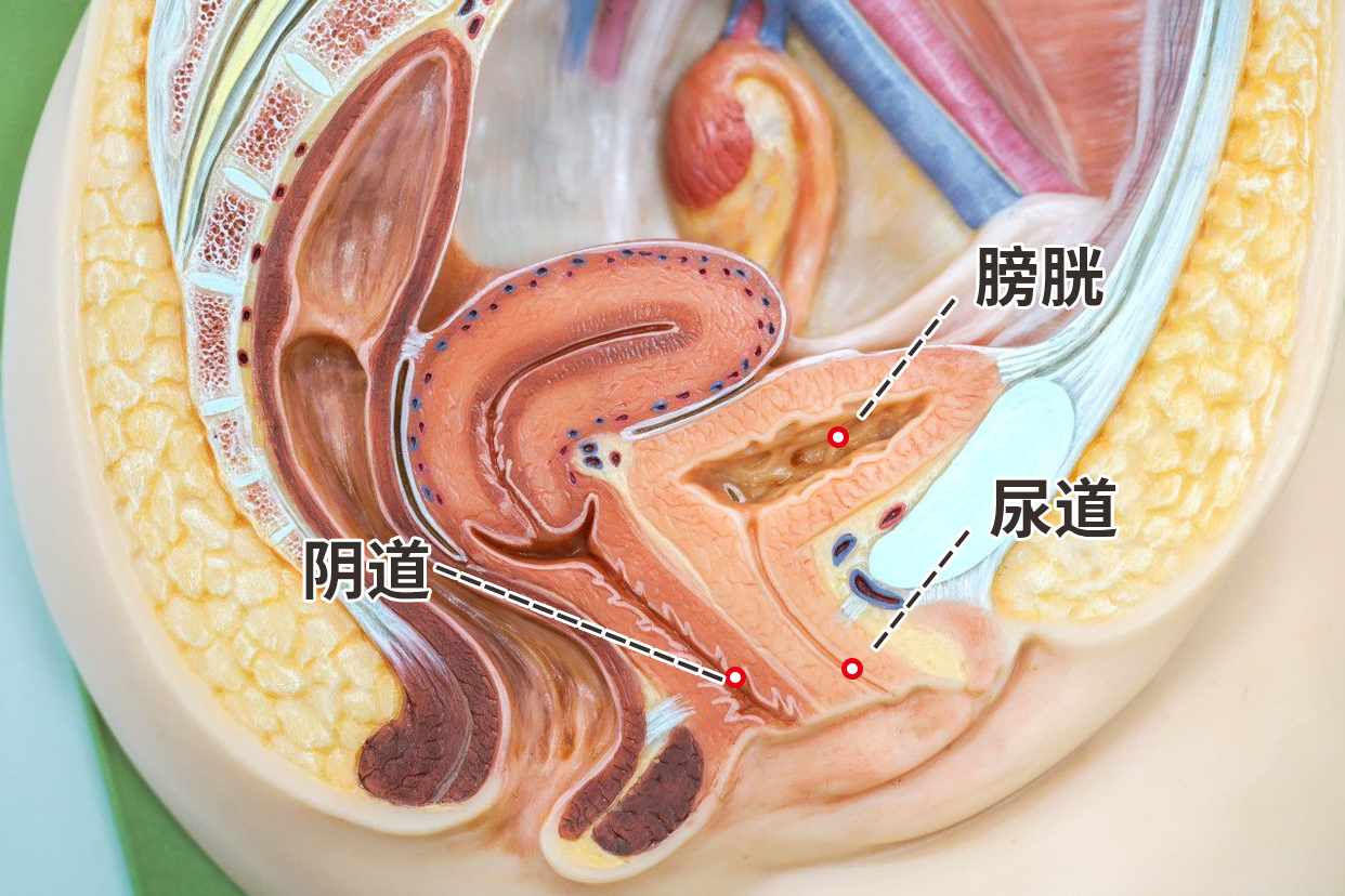 尿道膀胱阴道图