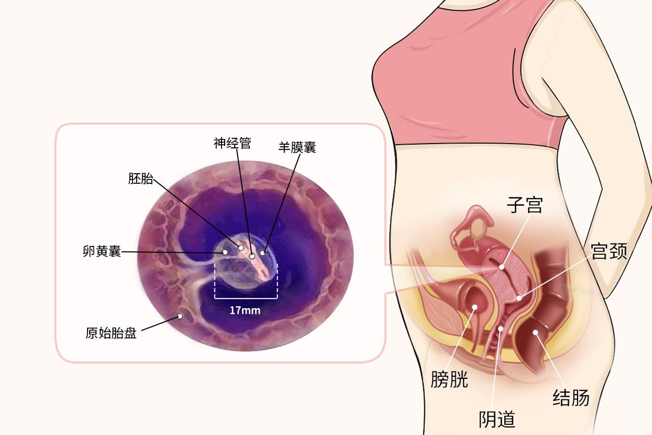 17mm孕囊有多大图片