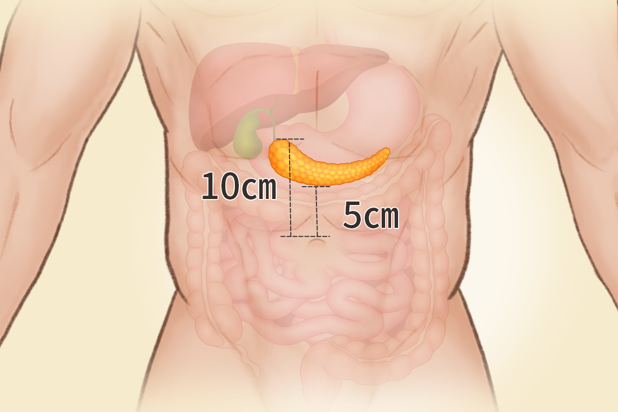 胰腺体表投影区位置图 胰腺体表投影位置图片