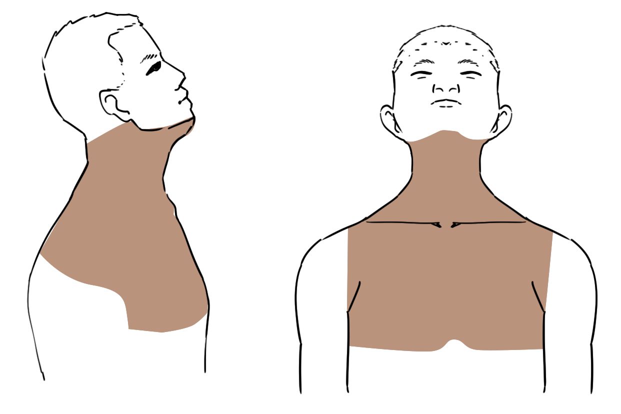 颈部手术消毒范围示意图（颈部手术的消毒范围）