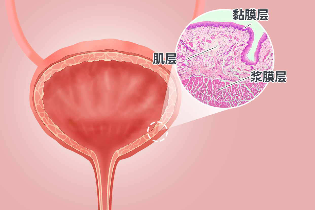 膀胱壁分层示意图（膀胱壁几层结构）