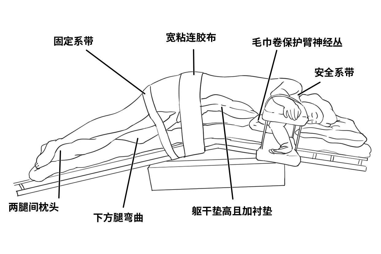 泌尿外科半侧卧位的摆放图片 患侧卧位摆放图片