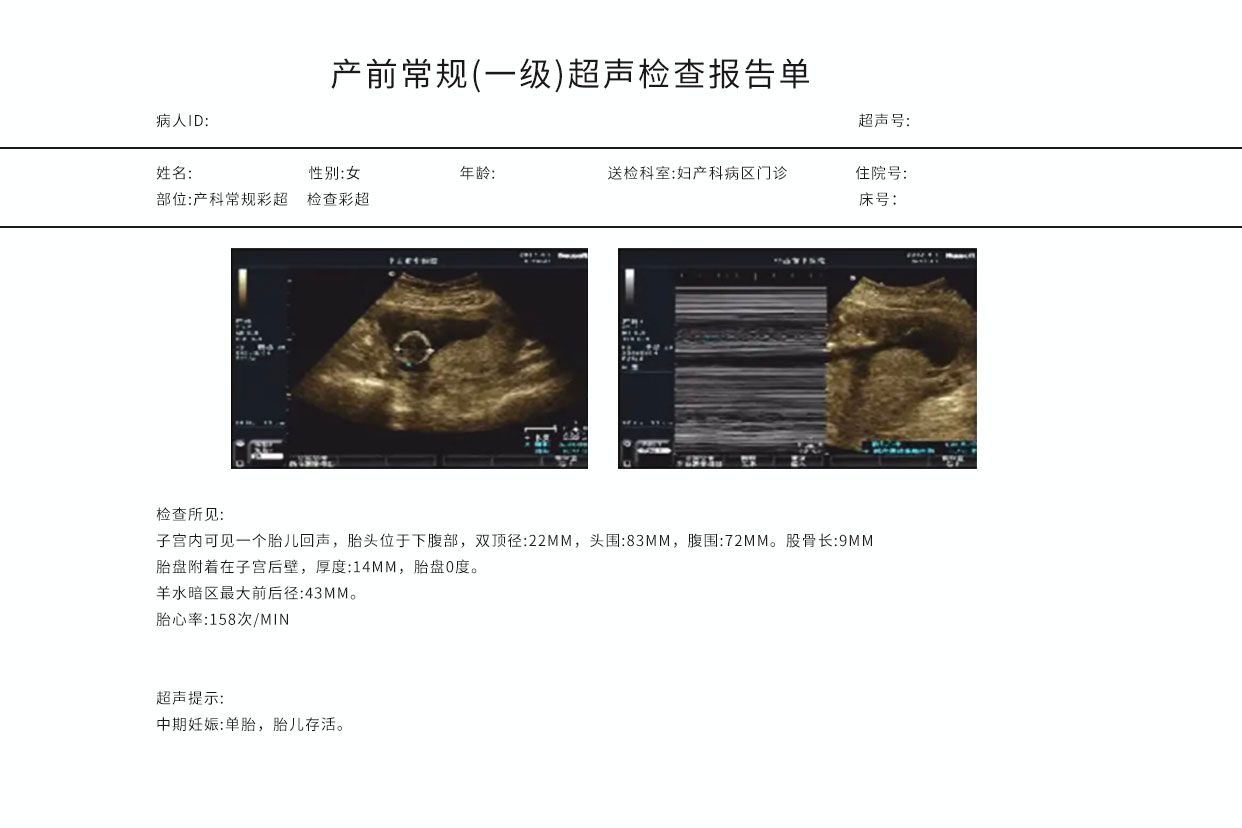 产科超声检查报告图解（产科超声报告单图片）