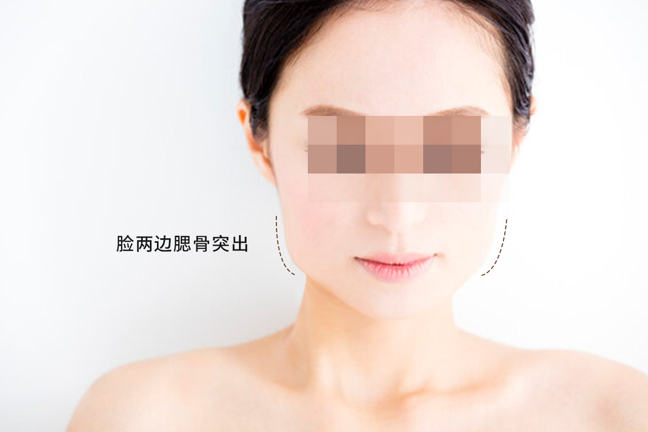 女人脸两边腮骨突出图片（女人脸两边腮骨突出图片大全）