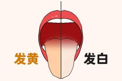 舌苔厚白和厚黄的区别图片（舌苔厚白和厚黄的区别图片对比）