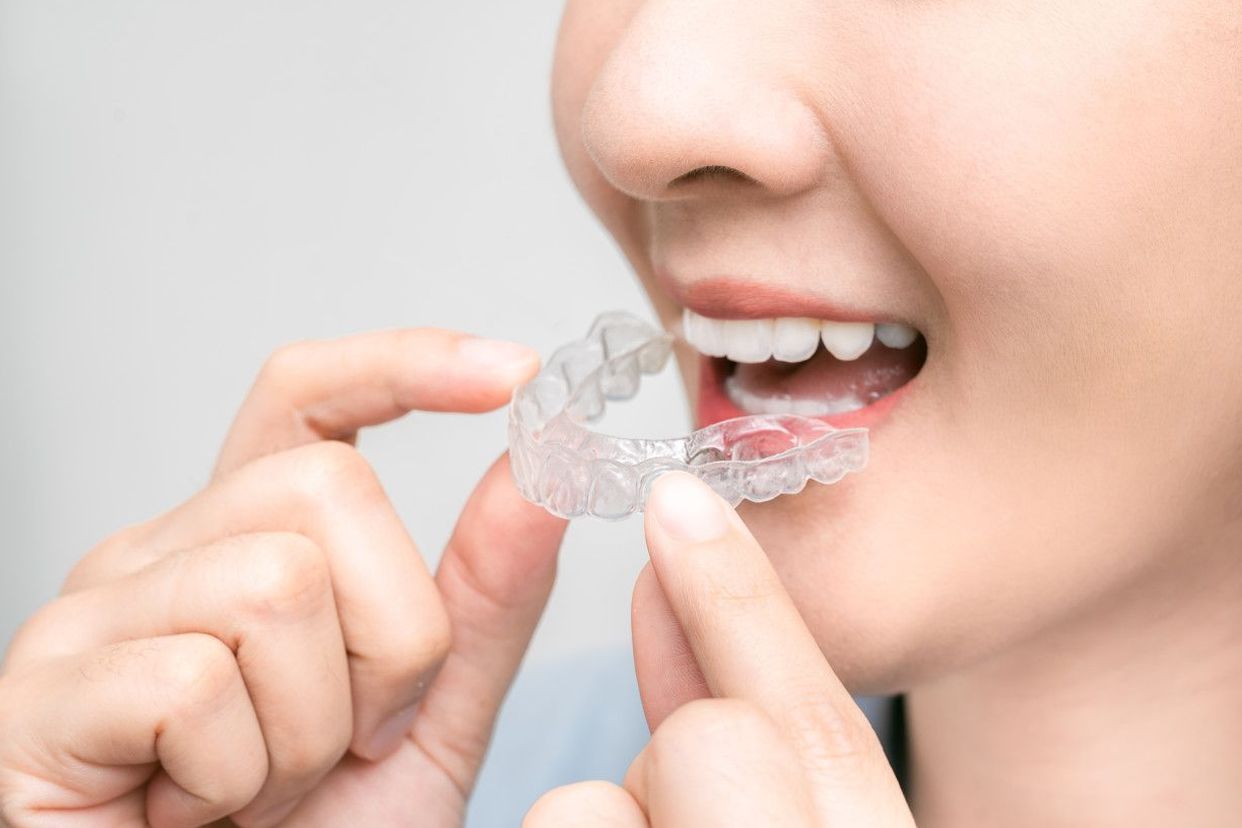 牙釉质透明照片（牙釉质透明照片高清）