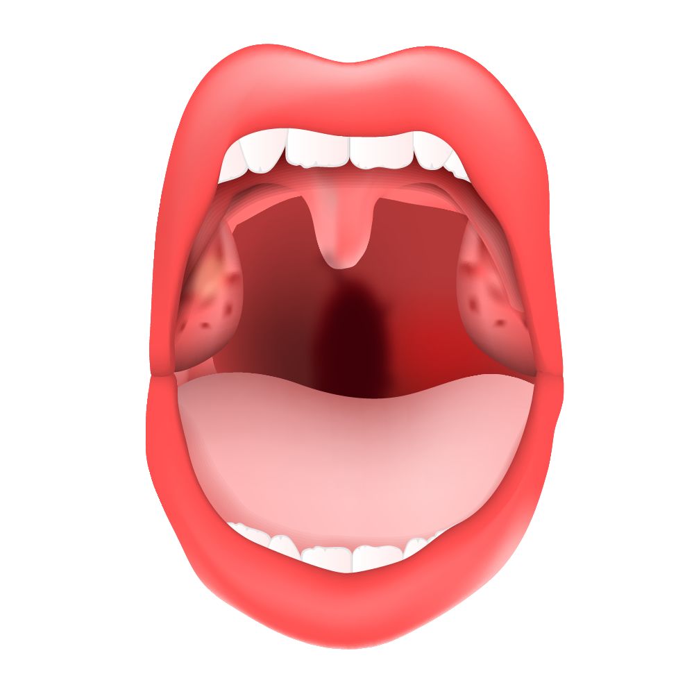 舌弓发炎图片 舌炎的症状图片舌头