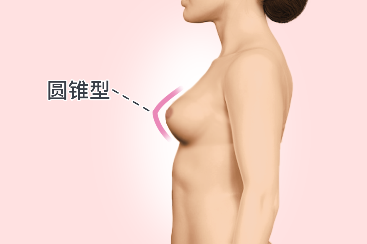 圆锥型胸型图片（圆锥形状的胸）