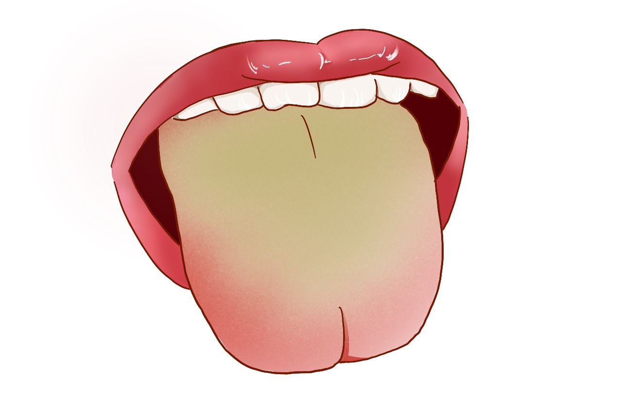 膀胱湿热舌苔图片 膀胱湿热舌苔图片大全