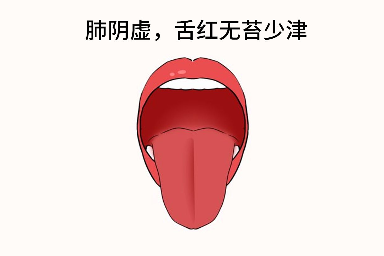 肺阴虚的舌头图片