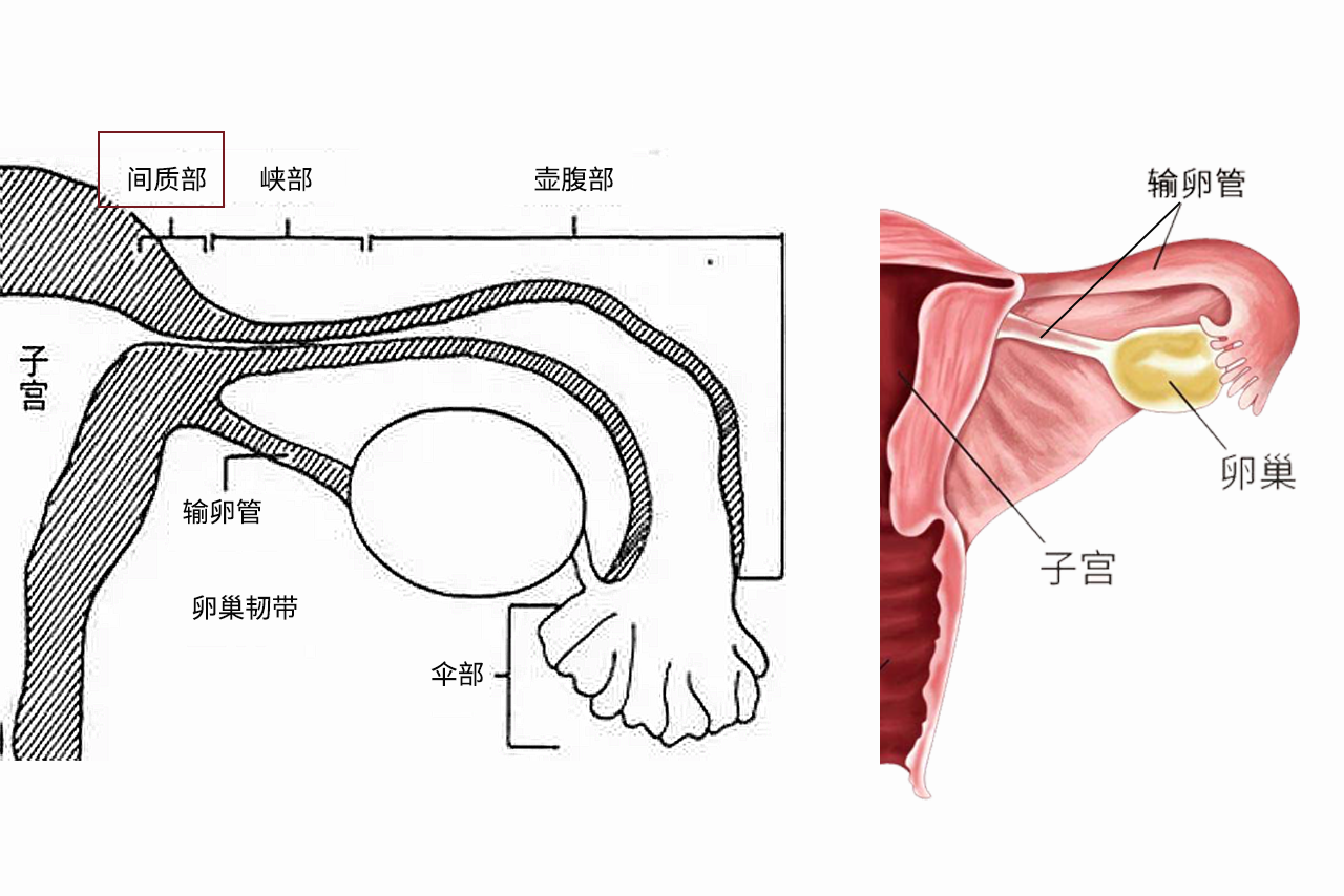 输卵管间质部图片（输卵管间质部的图片）