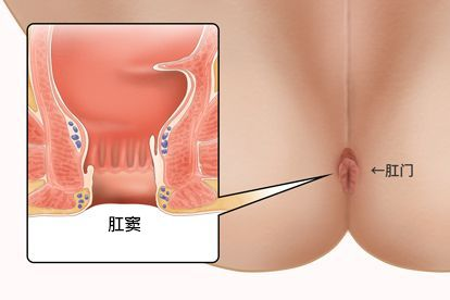 肛窦解剖图 肛窦的解剖示意图