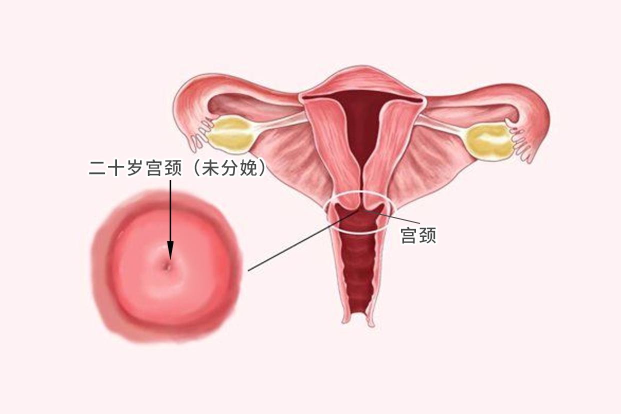 二十岁宫颈图片（二十多岁宫颈萎缩的原因）