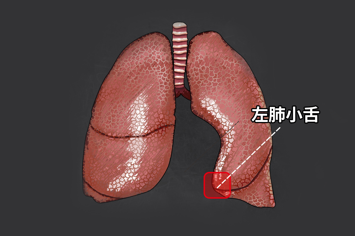左肺小舌图片 左肺小舌解剖图