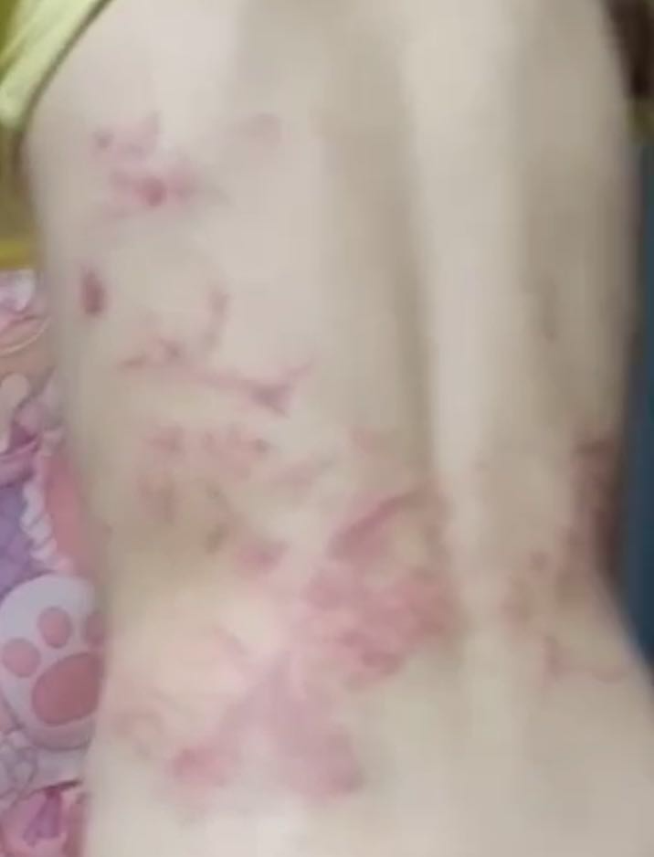重庆12岁男孩被生父和继母殴打至遍体鳞伤！其父首次发声